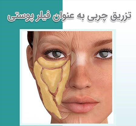 تزریق چربی به صورت؛ جوان‌سازی واقعی یا ریسک پنهان؟