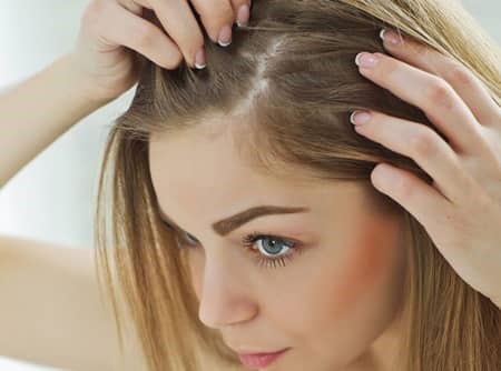 چه کارهایی را نباید انجام دهیم تا دچار ریزش مو نشویم؟